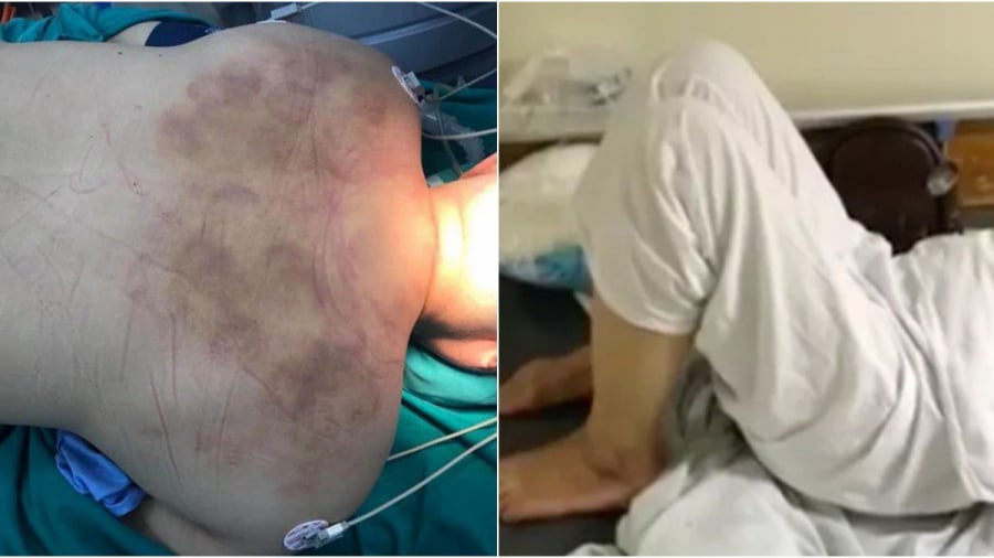 cho thay lang nan bop 6 tieng nguoi phu nu bi liet-phunutoday