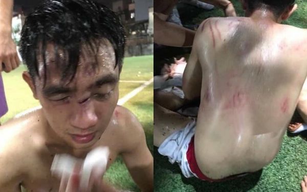 Cầu thủ bị đội xăm trổ hành hung.