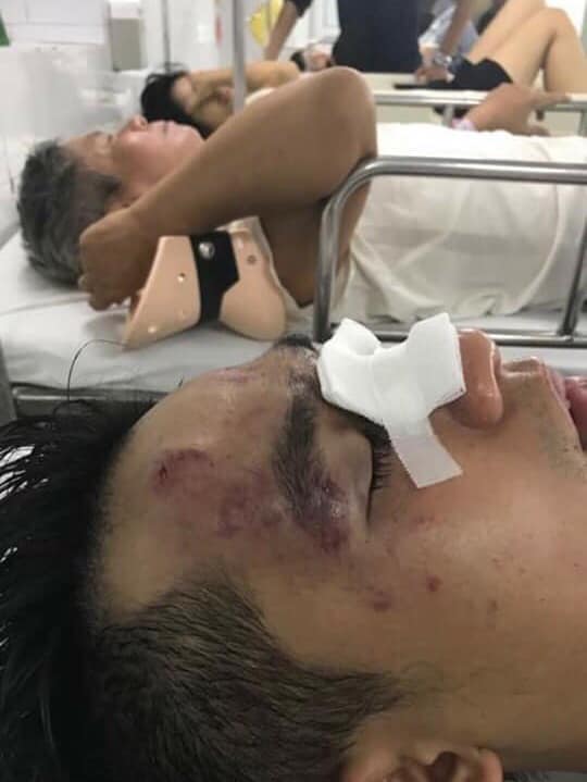 Một số cầu thủ phải nhập viện sau sự việc.