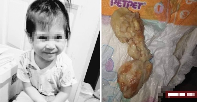 Bé gái tử vong vì hóc bánh mì.
