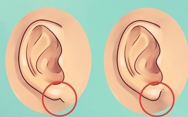 Người có tai dày thường giàu có