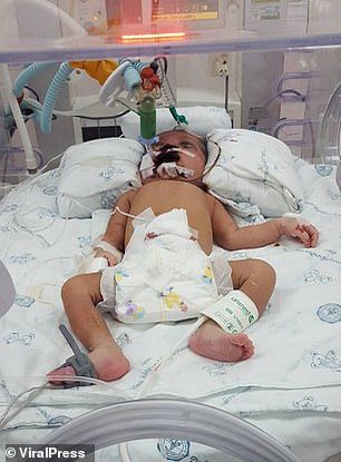 Bé sơ sinh tử vong sau vài ngày được đưa vào viện cấp cứu. Ảnh: Viral Press