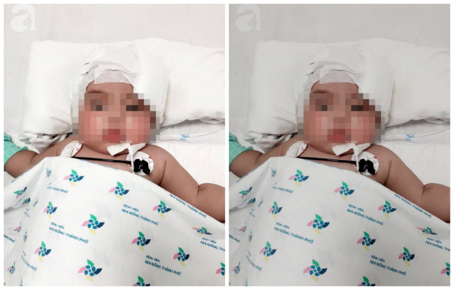 Bé 5 tuổi bị u não