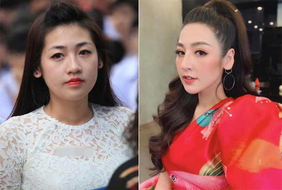 Dù được đánh giá cao về nhan sắc tự nhiên không dao kéo, nhưng thời gian gần đây cộng đồng mạng bắt đầu phát hiện ra những điểm khác thường trên gương mặt nàng Á hậu. Theo đó trong một vài bức ảnh được đăng tải gần đây, gương mặt của Tú Anh trở nên thon gọn, chiếc cằm nhọn và sống mũi cao hơn so với trước.    