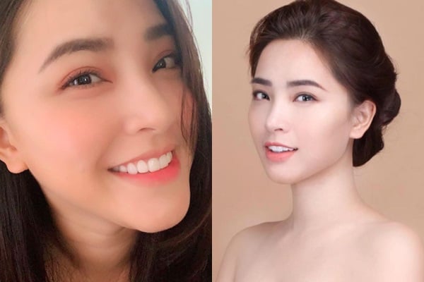 Thời gian sau khi trải qua cuộc sinh nở lần thứ ba, Hải Băng nhanh chóng lấy lại thân hình thon gọn khiến khuôn mặt trở nên nhẹ nhõm, gương mặt lọ rõ đường cằm V-line. Chính vì thế, nữ ca sĩ vô tình vướng phải nghi vấn độn cằm. Trước những bàn tán của dư luận, mới đây trên trang cá nhân, Hải Băng đã đăng tải hình ảnh cận mặt kèm lời giải thích: 