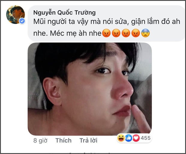 Nam diễn viên tỏ ra khá bức xúc khi bị nói chỉnh sửa mũi nên mới có diện mạo như hiện tại.    