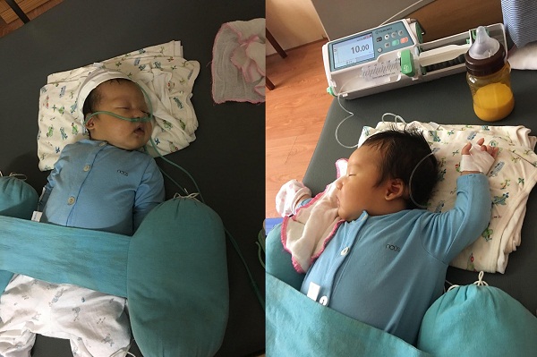 Bé trai hơn 20 ngày tuổi bị suy hô hấp sau nụ hôn âu yếm của chị gái.