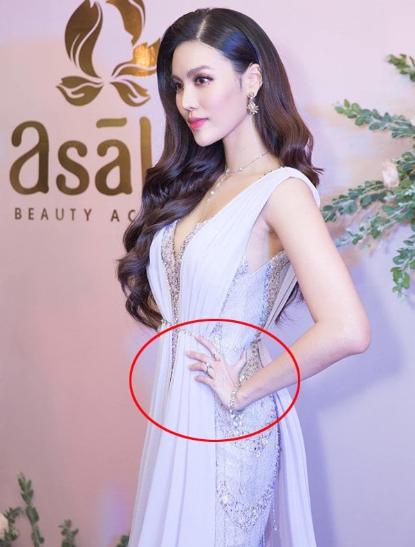 Lan Khuê bị tố bóp bụng khiến tay bị kéo dài kỳ dị