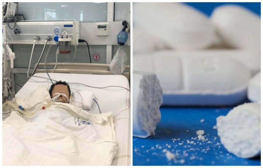 Trẻ hai tuổi suy gan vì mẹ dùng thuốc hạ sốt quá liều