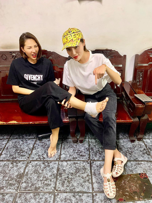 Kỳ Duyên hài hước nói rằng mình còn đau hơn cái chân của Minh Triệu.    
