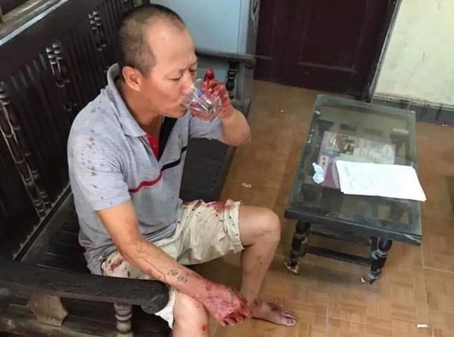 Nguyễn Văn Đông sau thời điểm gây án.