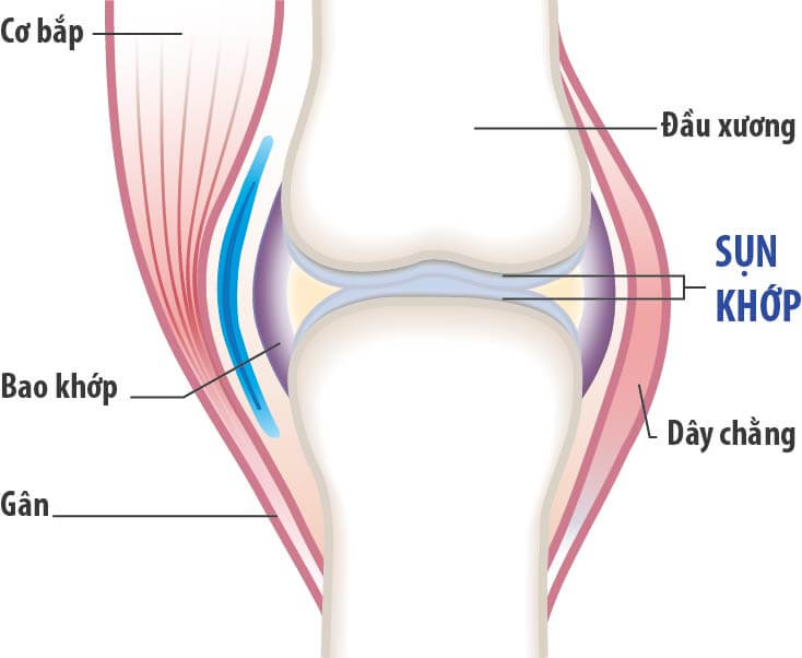 Sụn khớp bị mòn đi do tuổi tác, giảm tiết dịch khớp là nguyên nhân phổ biến gây ra bệnh khô khớp, khiến xương phát ra tiếng kêu lục cục khi vận động.