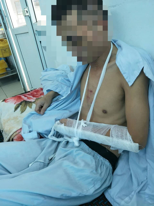 Cô nàng đánh người yêu đến gãy tay vì like ảnh gái lạ.
