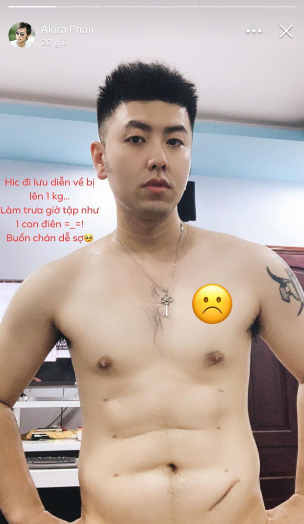 Hình ảnh lộ nguyên vết tích dao kéo gây sốc của Akira Phan.    