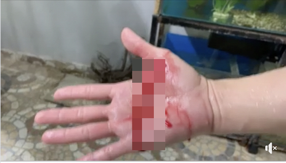 Theo lời kể của Đan Trường, trước khi đi ngủ, anh thường dạo một vòng thăm hồ cá trong nhà, trong số đó có bầy cá hổ Piranha. Vô tình khi cho tay nhặt cành cây trong bể cá, một con cá to nhất đã lao đến đớp tay anh khiến máu chảy không ngừng. Vết thương rất sâu và liên tục chảy máu khiến nam ca sĩ có hiện tượng chóng mặt. Ngay khi câu chuyện được chia sẻ, cộng đồng mạng vô cùng hoảng loạn. Đồng thời, mọi người cũng dành lời khuyên cho nam ca sĩ không nên nuôi loại cá quá dữ này để tránh tổn hại bản thân.