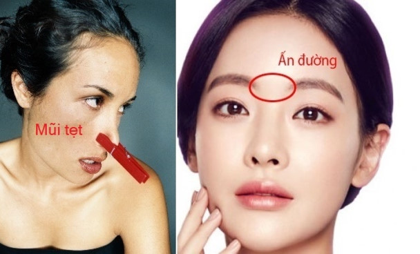 Phụ nữ mũi tẹt số khổ