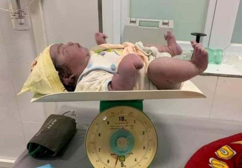 Bé gái nặng 5,5 kg chào đời khỏe mạnh (Ảnh: Giản Viết Hợp)