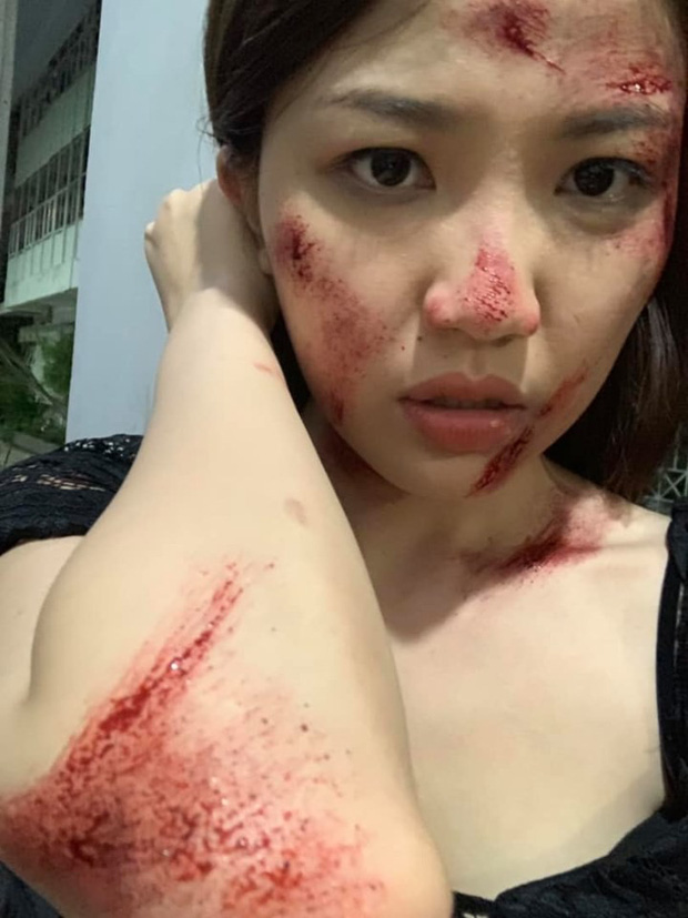 Lương Thanh bất ngờ chia sẻ trên trang cá nhân hình ảnh mới nhất của mình. Điều khiến cộng đồng mạng hoang mang chính là gương mặt xước xát, chi chít những vết thương của nữ diễn viên trẻ. Theo đó, Lương Thanh tiết lộ: 
