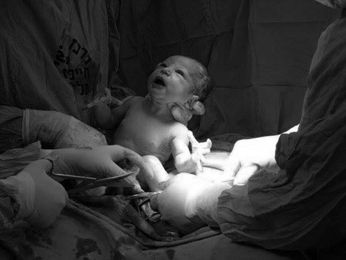 Dù sinh thường hay sinh mổ, người mẹ vẫn phải chịu rất nhiều đau đớn. Nhưng chỉ cần con chào đời khỏe mạnh là mẹ mãn nguyện.