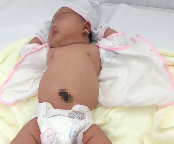 Bé gái chào đời nặng 5,2kg.