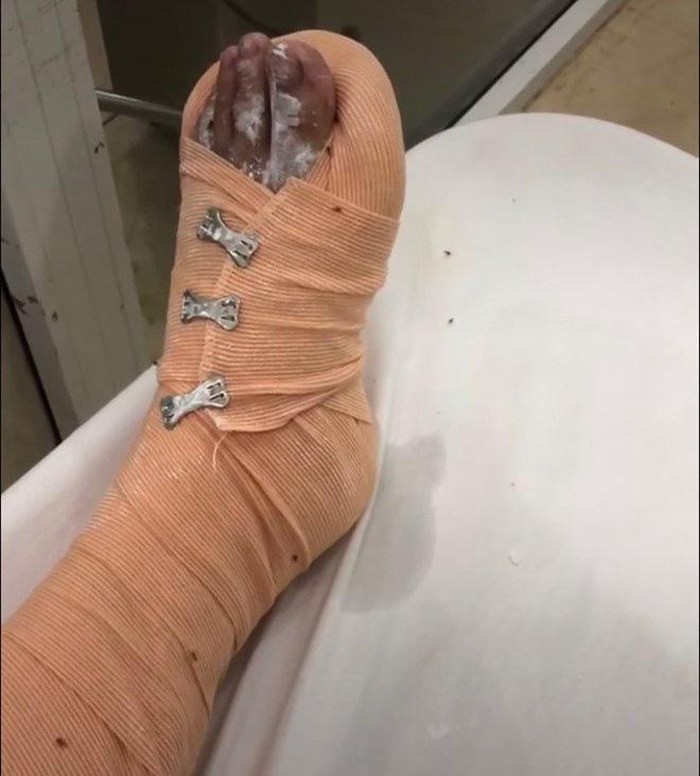 Một trong những vết thương của chị N.