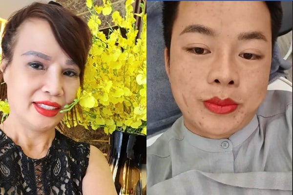 Cô dâu 62 tuổi cùng chồng đi xăm môi.