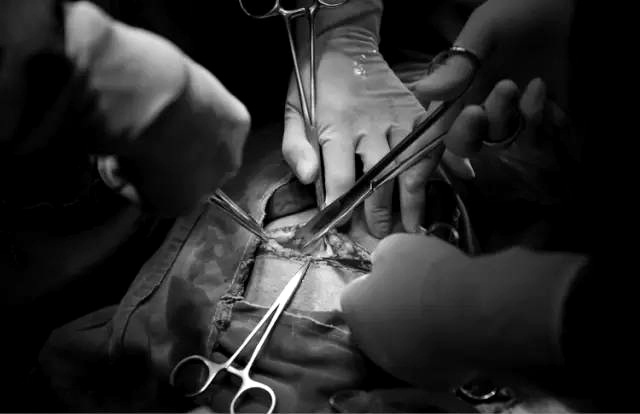 Nhờ tác dụng của thuốc gây tê hoặc gây mê, mẹ sẽ không cảm nhận được cơn đau trong suốt quá trình Shbet888 tiền thưởng cực khủng. Sau khi mở từng lớp dưới bụng, tử cung sẽ lộ ra.
