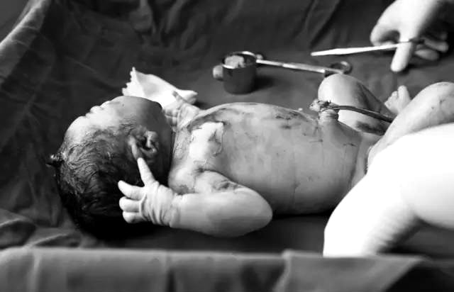 Sau đó, dây rốn sẽ được cắt.