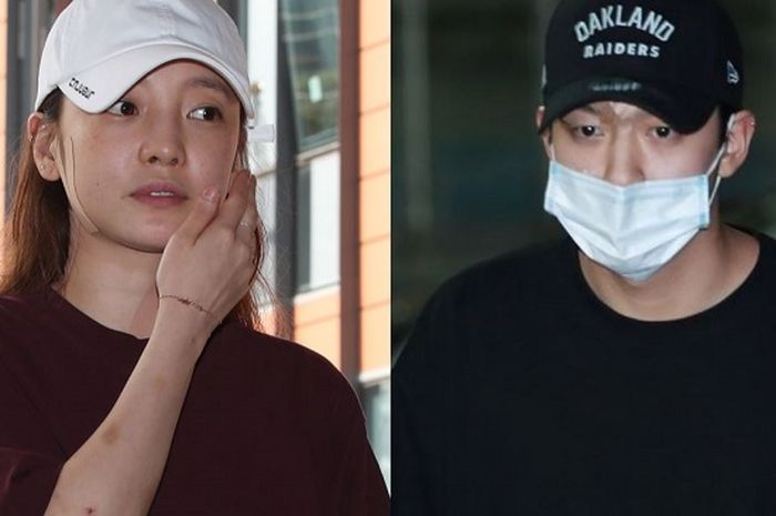 Goo Hara tiều tụy với chằng chịt những vết thương trên Sh88bet đăng ký miễn phí trong scandal với bạn trai cũ