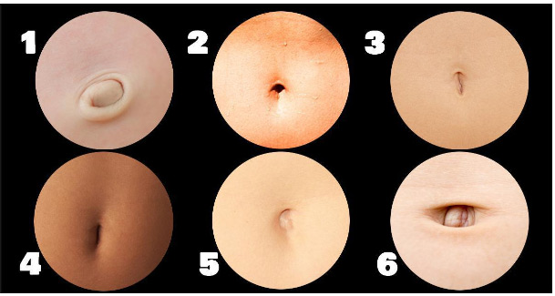 Tướng rốn cho biết tương lai