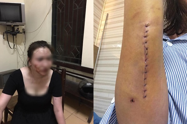 Hình ảnh người vợ đăng tải.