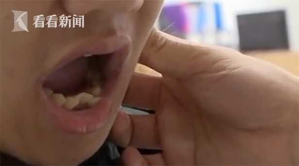 Anh chàng không ngậm được miệng sau khi cười 