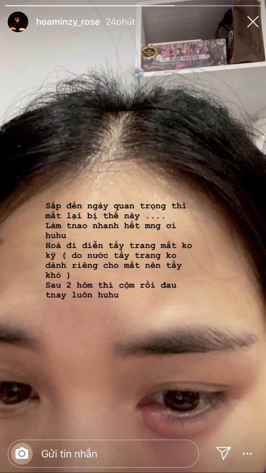 tay-trang-khong-dung-cach-hoa-minzy-cuong-cuong-cau-cuu-cdm-cach-chua-doi-mat-sung-phong-82008876_637401757010901_623777071268626432_n-1578116044-424-width1152height2048