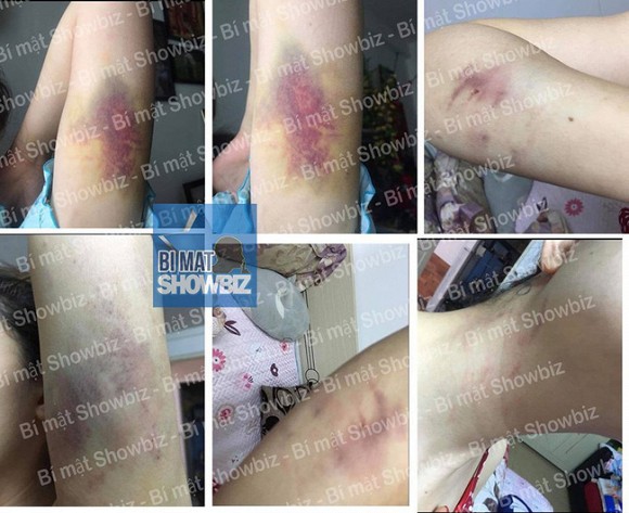 Quốc Bảo đã phụ bạc người cũ và có hành vi vũ phu. (Ảnh: Bí mật showbiz)