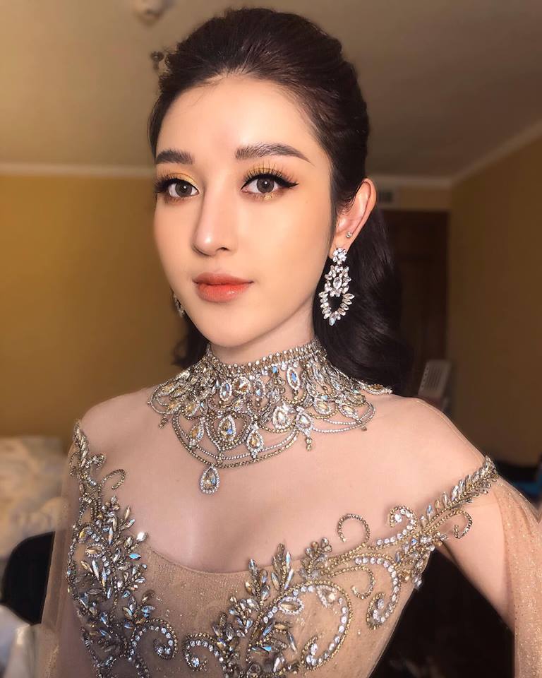 Hình ảnh chứng minh mũi của người đẹp sưng và sống mũi đầy đặn hơn hẳn với trước.  