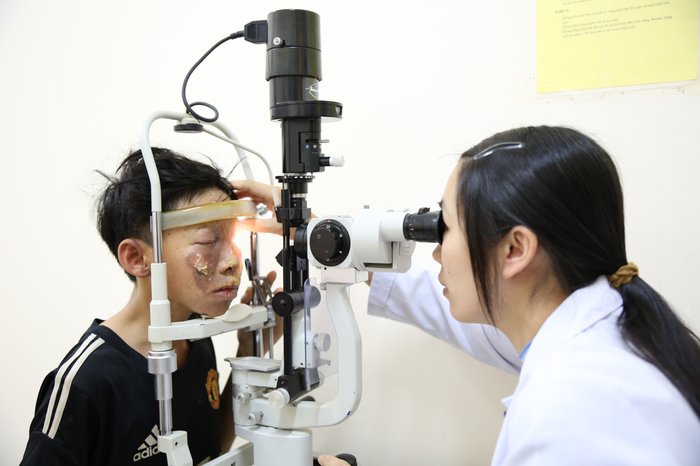 Bệnh nhân S. bị bỏng nặng phần mặt do tự chế tạo pháo.