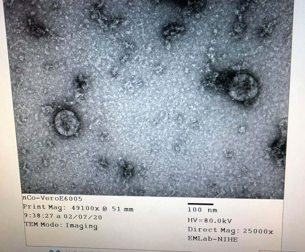 Việt Nam nuôi cấy và phân lập thành công virus corona mới (Nguồn: Bộ Y tế)