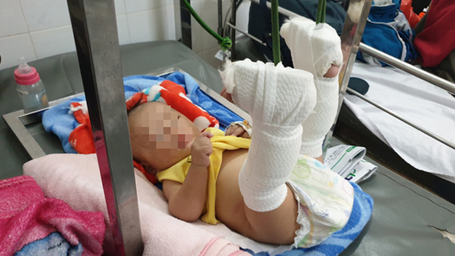 Bé K. được điều trị tại Bệnh viện Nhi đồng 2.