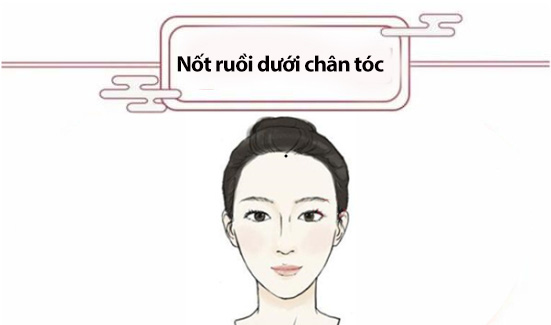 not-ruoi-tren-mat-01