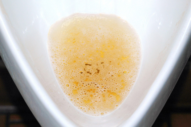 nuoc tieu buoi sang-phunutoday