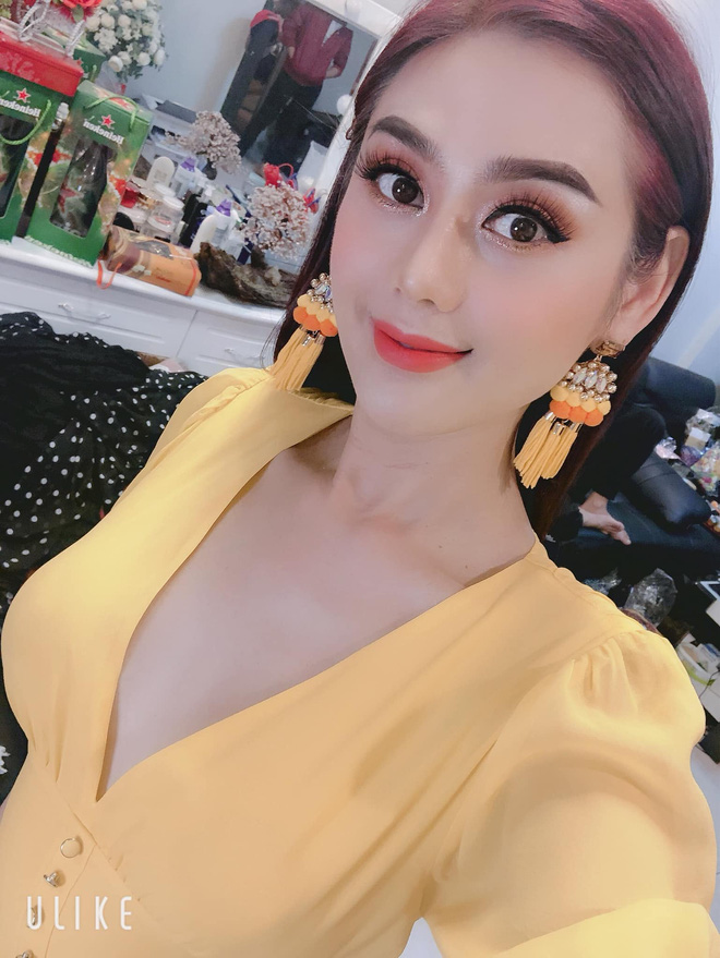 nhin-lam-khanh-chi-la-qua-di-mat-khoe-anh-mat-moc-ma-doi-mat-xech-va-sung-vu-cu-choan-het-ca-spotlight-b3a-4759482