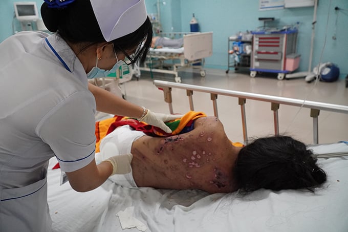 Cô gái trẻ bị chủ quán cà phê đánh đập, tra tấn dã man. Ảnh: Hoàng Trường