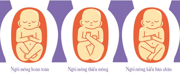 4-vi-tri-nam-cua-thai-nhi-trong-bung-me-tu-the-dau-tien-la-tot-nhat-7-1586721914-4-width600height250
