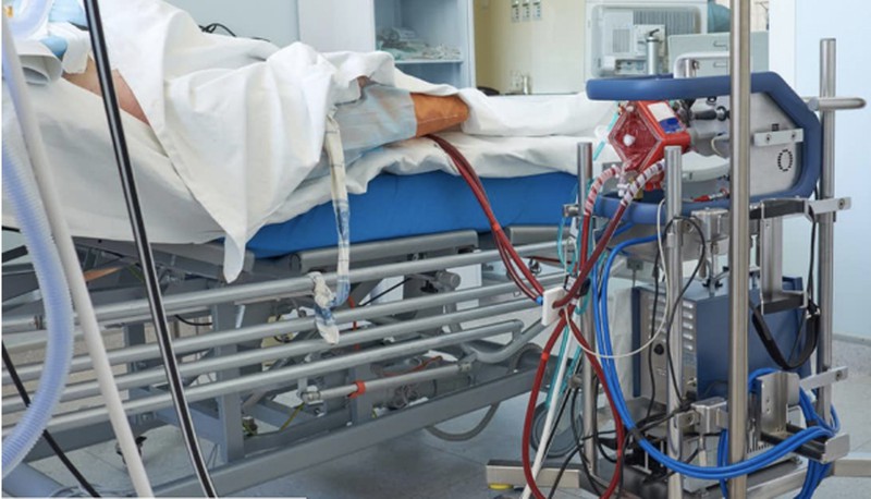 Bệnh nhân 91 tiếp tục thở máy và can thiệp ECMO.