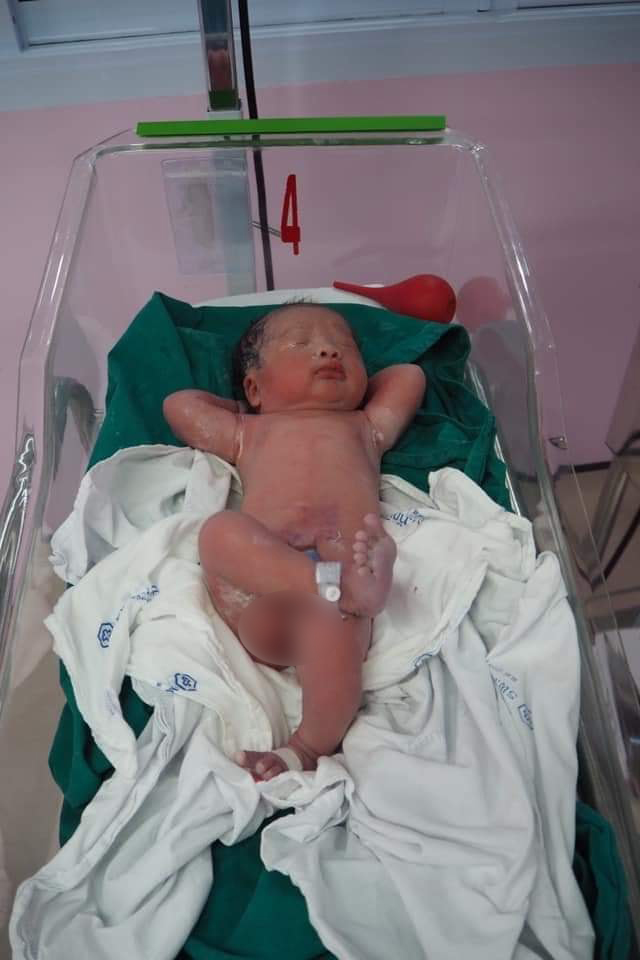 Bé sơ sinh vừa lọt lòng mẹ đã 