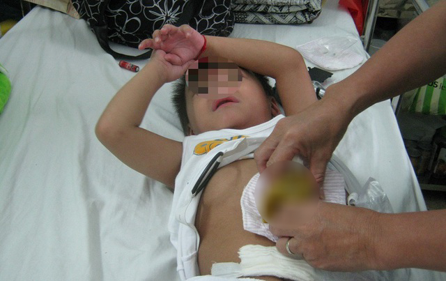so-den-vien-vi-covid-19-hai-be-trai-nguy-kich-vi-vo-ruot-thua-phunutoday-02