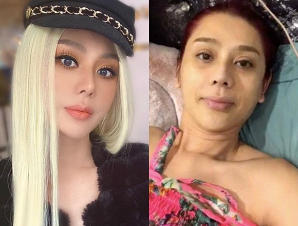 Mới đây, Lâm Khánh Chi lại bị đăng ảnh dìm nhan sắc. Cụ thể, cô bị ghép ảnh trước và sau đeo lens. 