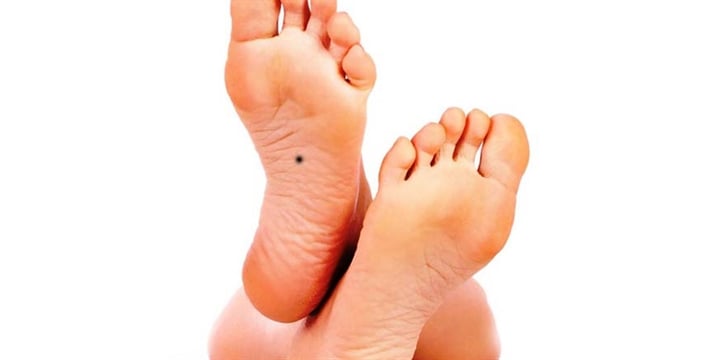 Nốt ruồi ở bàn chân ở vị trí xấu khiến bạn cứ mãi bôn ba vất vả mà vẫn không thể giàu lên được. (Ảnh minh họa)