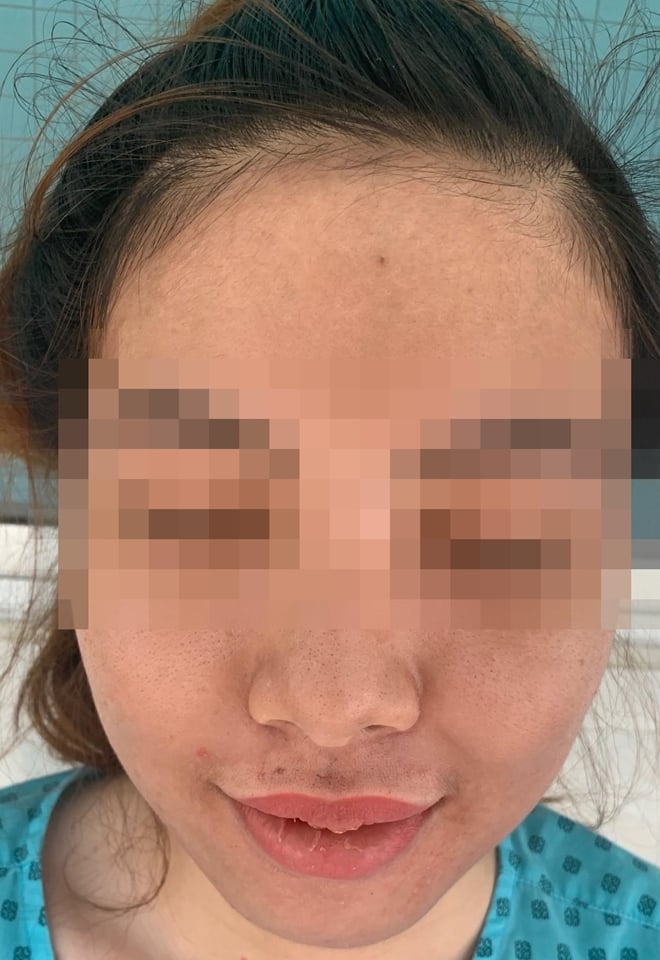 Da của bệnh nhân đã trở lại bình thường sau quá trình điều trị.