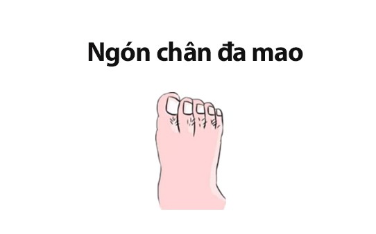 Tướng bàn chân phụ nữ giàu có